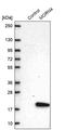 MORN Repeat Containing 4 antibody, PA5-62670, Invitrogen Antibodies, Western Blot image 