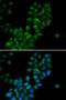 Calcium Activated Nucleotidase 1 antibody, LS-C346118, Lifespan Biosciences, Immunofluorescence image 