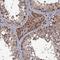 MIER Family Member 2 antibody, HPA041439, Atlas Antibodies, Immunohistochemistry paraffin image 