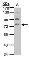 Protein kinase C gamma type antibody, PA5-28618, Invitrogen Antibodies, Western Blot image 