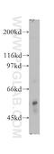Serine/threonine-protein phosphatase 2B catalytic subunit beta isoform antibody, 13340-1-AP, Proteintech Group, Western Blot image 