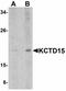 BTB/POZ domain-containing protein KCTD15 antibody, LS-B4997, Lifespan Biosciences, Western Blot image 