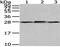 Nicotinamide N-Methyltransferase antibody, PA5-51252, Invitrogen Antibodies, Western Blot image 