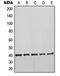 Keratin 19 antibody, MBS822263, MyBioSource, Western Blot image 