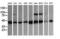 Acetyl-CoA Acyltransferase 2 antibody, M08341, Boster Biological Technology, Western Blot image 