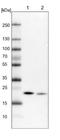 NADH:Ubiquinone Oxidoreductase Subunit B9 antibody, NBP1-88940, Novus Biologicals, Western Blot image 