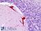 Disabled homolog 1 antibody, LS-B9240, Lifespan Biosciences, Immunohistochemistry frozen image 