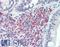 FcRIIIb antibody, LS-B15673, Lifespan Biosciences, Immunohistochemistry paraffin image 