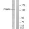Diacylglycerol Kinase Delta antibody, A09644, Boster Biological Technology, Western Blot image 