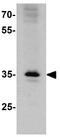 Phosducin-like protein antibody, GTX31582, GeneTex, Western Blot image 