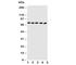 ATP Binding Cassette Subfamily G Member 5 antibody, R30970, NSJ Bioreagents, Western Blot image 