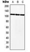 MKL/myocardin-like protein 2 antibody, GTX56012, GeneTex, Western Blot image 