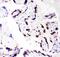 CEBPB antibody, PB9171, Boster Biological Technology, Immunohistochemistry paraffin image 