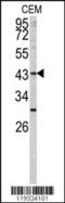 Fucosyltransferase 1 (H Blood Group) antibody, 62-333, ProSci, Western Blot image 