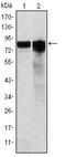 GYS antibody, MA5-15802, Invitrogen Antibodies, Western Blot image 