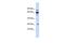 Defective In Cullin Neddylation 1 Domain Containing 3 antibody, PA5-44000, Invitrogen Antibodies, Western Blot image 