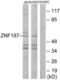 Zinc Finger And SCAN Domain Containing 26 antibody, LS-C119083, Lifespan Biosciences, Western Blot image 