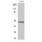 Acrosin antibody, LS-C387895, Lifespan Biosciences, Western Blot image 