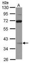 Single-stranded DNA-binding protein 3 antibody, GTX115748, GeneTex, Western Blot image 