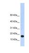 Zinc Finger Protein 493 antibody, NBP1-91547, Novus Biologicals, Western Blot image 