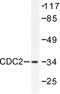 Cyclin Dependent Kinase 1 antibody, AP06042PU-N, Origene, Western Blot image 