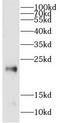 Complexin 3 antibody, FNab01923, FineTest, Western Blot image 