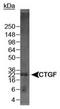 IBP-8 antibody, TA301728, Origene, Western Blot image 