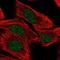 LXR beta antibody, NBP2-33801, Novus Biologicals, Immunocytochemistry image 