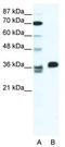 Homeobox protein ESX1 antibody, TA341509, Origene, Western Blot image 