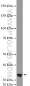 Centromere Protein P antibody, 18096-1-AP, Proteintech Group, Western Blot image 