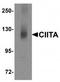 Class II Major Histocompatibility Complex Transactivator antibody, TA319682, Origene, Western Blot image 