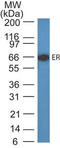 Estrogen Receptor 1 antibody, AM50107PU-T, Origene, Western Blot image 