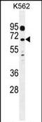 Leucine Rich Repeat Containing 63 antibody, PA5-71596, Invitrogen Antibodies, Western Blot image 