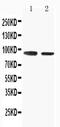 Solute Carrier Family 9 Member A2 antibody, PA5-80034, Invitrogen Antibodies, Western Blot image 