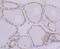 Barrier To Autointegration Factor 1 antibody, A02734-2, Boster Biological Technology, Immunohistochemistry frozen image 