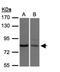 Xenotropic and polytropic retrovirus receptor 1 antibody, NBP1-31083, Novus Biologicals, Western Blot image 