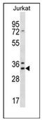 DnaJ Heat Shock Protein Family (Hsp40) Member C9 antibody, AP51297PU-N, Origene, Western Blot image 