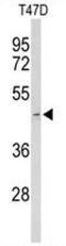 Acrosin antibody, AP50058PU-N, Origene, Western Blot image 