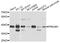 Protein Kinase AMP-Activated Non-Catalytic Subunit Beta 1 antibody, STJ111035, St John