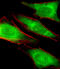 Proteasome 26S Subunit, ATPase 1 antibody, MBS9211794, MyBioSource, Immunofluorescence image 