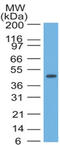 Keratin 17 antibody, AM50131PU-T, Origene, Western Blot image 