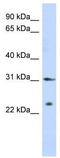 SSX Family Member 5 antibody, TA339524, Origene, Western Blot image 