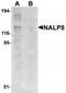 NLR Family Pyrin Domain Containing 8 antibody, TA320092, Origene, Western Blot image 