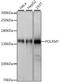 RNA Polymerase Mitochondrial antibody, A06341, Boster Biological Technology, Western Blot image 