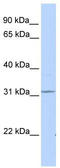 Hematopoietically-expressed homeobox protein HHEX antibody, TA344494, Origene, Western Blot image 