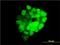 Integrin Subunit Beta 3 Binding Protein antibody, H00023421-M01, Novus Biologicals, Immunocytochemistry image 