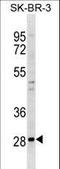 Zinc Finger Protein 688 antibody, LS-C157490, Lifespan Biosciences, Western Blot image 