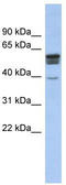 Sphingolipid Transporter 2 antibody, TA335127, Origene, Western Blot image 