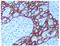 Keratin 14 antibody, SM1359PT, Origene, Immunohistochemistry frozen image 