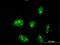 Zinc Finger Protein 611 antibody, MA5-22687, Invitrogen Antibodies, Immunofluorescence image 